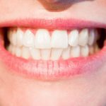 teeth-1652976_640