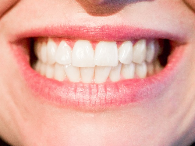 Smile! Because The Right Dental Implant Clinic Is Closer Than You Think